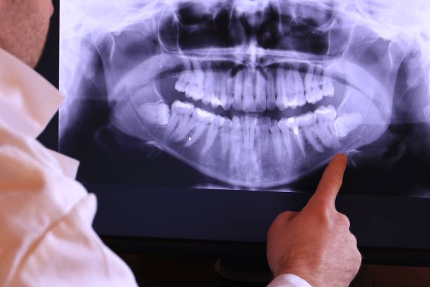 Best Emergency Root Canal Treatment in Kemah, TX