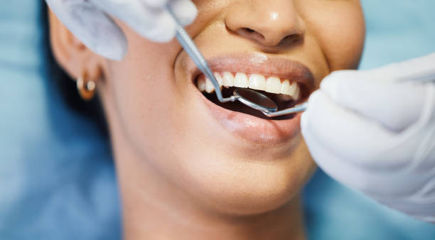Best Mobile Emergency Dentist in Kemah, TX