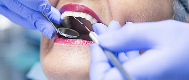 Best Emergency Dental Extractions in Kemah, TX